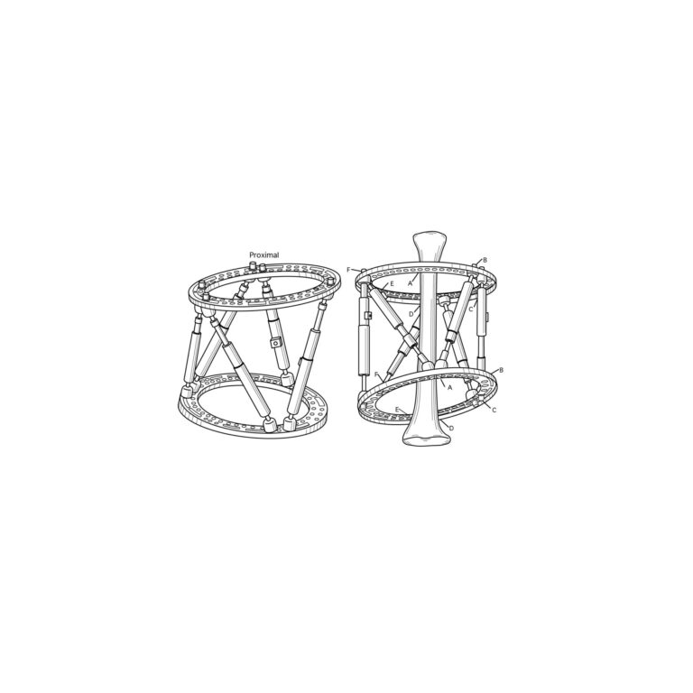 Medical Patent Illustration