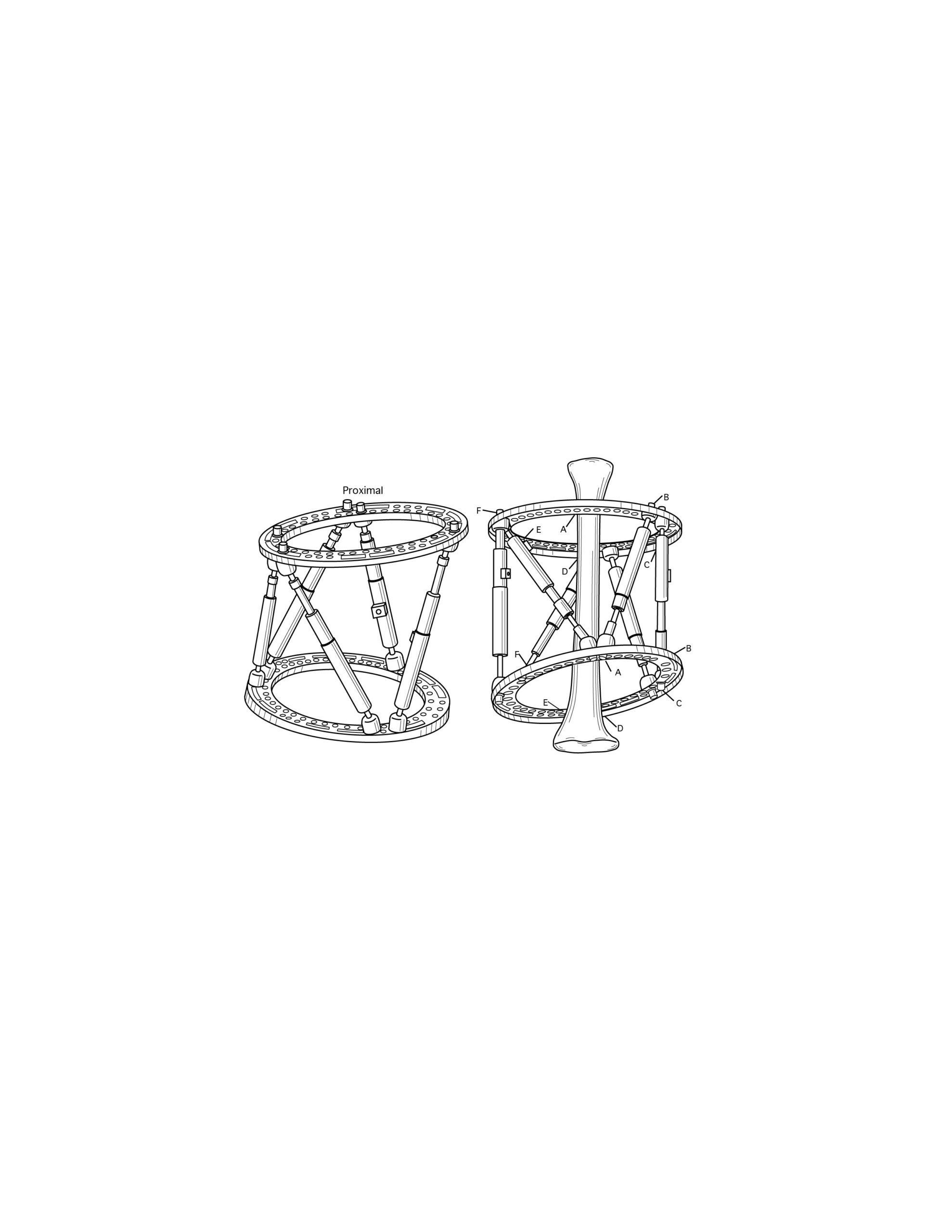 Medical Patent Illustration